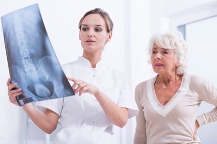 แพทย์แสดงภาพ x -ray ของกระดูกสันหลัง