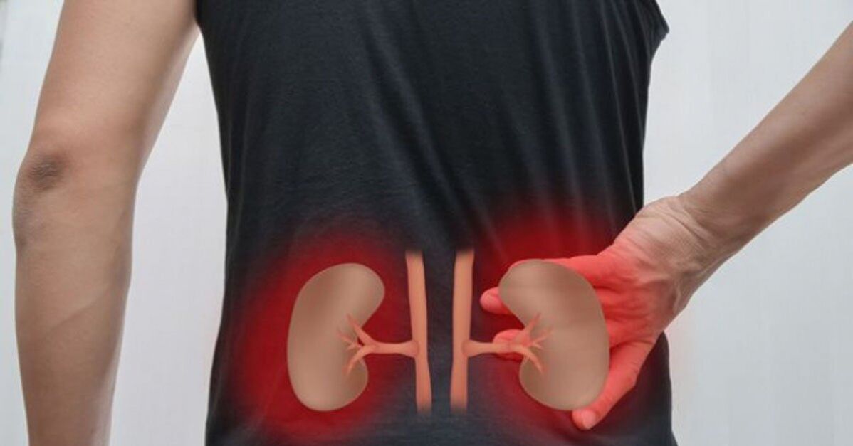 โรคไตอันเป็นสาเหตุของอาการปวดหลังส่วนล่าง