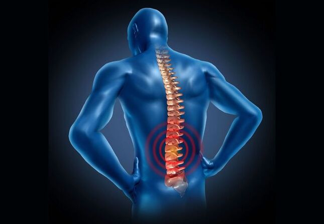 Osteochondrosis ของกระดูกสันหลังส่วนเอวเป็นโรคที่เกิดขึ้นในคนส่วนใหญ่